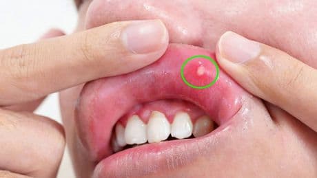 5 belirgin B vitamini eksikliği belirtisi: Vücut için hayati önemi var