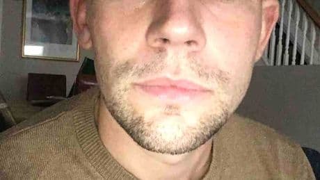 My cocaine bender left me BLIND – I had ‘devil eyes’ for months and was chased by a man with a bible