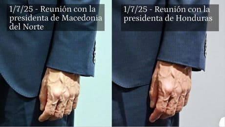 La mano del capitán: el estrés de Sánchez acentúa su delgadez, los signos de artrosis y la hinchazón de sus venas