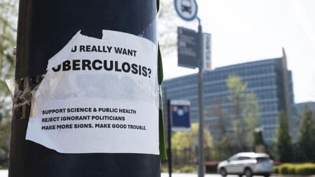 Student diagnosed with tuberculosis at Florida high school