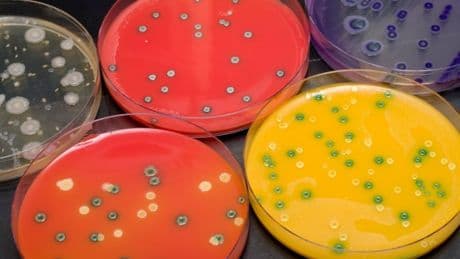 One killed in Listeria outbreak sparking urgent recall on supermarket ready meals