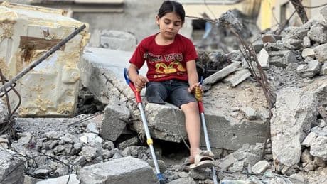 Génocide à Gaza : au moins 21 000 enfants handicapés à cause des bombardements