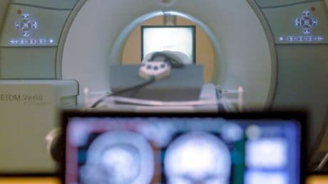 Muere un hombre tras ser succionado por una máquina de resonancias en EE UU