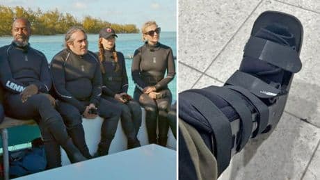 ITV star reveals gruesome broken bone was kept secret on shark series