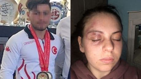 Milli sporcu eşinin şiddetinden sağ kurtulan kadın: “Birkaç saniye daha sürseydi ölebilirdim”