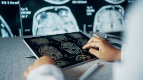 Radiología inteligente: el nuevo catálogo de los radiólogos incorpora datos clave para IA y eficiencia hospitalaria