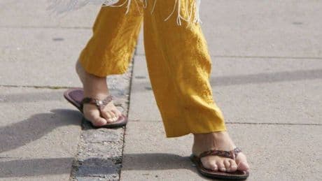 El abuso de chanclas en verano puede causar lesiones y sobrecargas