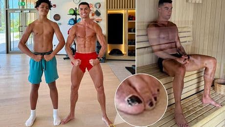 Cristiano Ronaldo spotted again with a black toenail as he shows off ripped physique with his son - but there's a good reason behind the bizarre look
