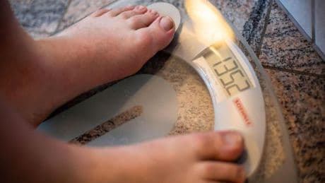 Having ADHD And Living In A Smaller City Might Increase Obesity Risk: Study