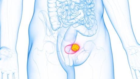 New treatment for devastating cancer that DOUBLES survival rate to be rolled out on NHS