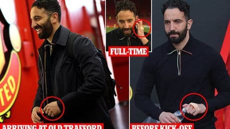 Man United manager Ruben Amorim is forced into covering latest cuts on his knuckle with a plaster just months after he 'smashed dressing room TV during angry outburst'