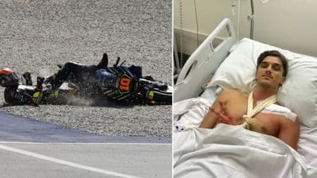 Schock-Moment in Japan - Motorrad-Superstar nach Sturz schwer verletzt