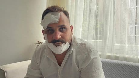 Eski sözlüye, polislerden öldüresiye dayak: 'Sülaleni öldürürüz'