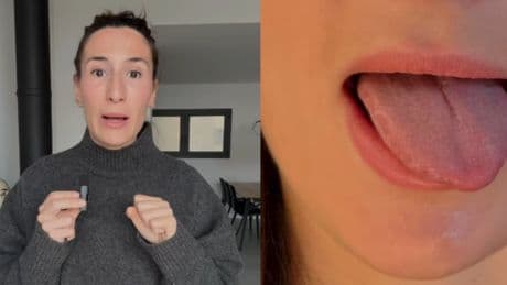 Beatriz Moralejo, experta en cirugía estética facial: “Si te levantas con marcas en la lengua, puede que estés apretando los dientes mientras duermes sin saberlo”