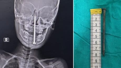 Man ‘drove three-inch nail into girl’s brain to stop her revealing sex abuse’