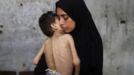 Gaza: Der Hunger ist echt, die Bilder sind es auch