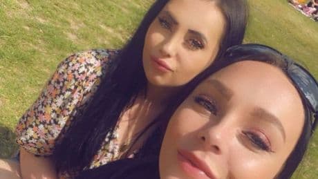 Mum left scarred for life after pal bit off part of her lip during drunken row