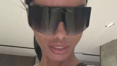 Katie Price left unable to complete basic functions after latest facial surgeries