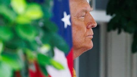 "Insufficienza venosa cronica": come sta davvero Donald Trump