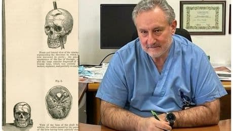 Un italiano sobrevive dos días en su casa con una flecha clavada en la cabeza