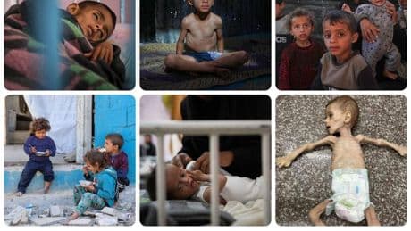 Bambini alla fame: le immagini da Gaza