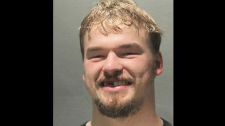 NHL star gets pepper-sprayed by cops trying to break up a fight - and gives toothless mugshot
