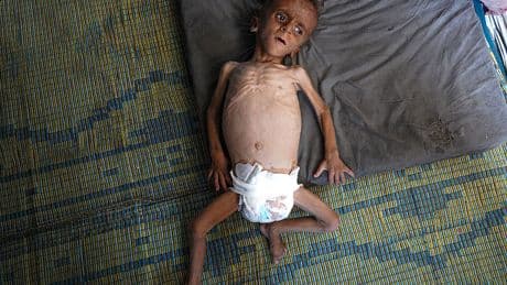 We Can Stop Gazans From Dying of Starvation Right Now. Here’s How We Do It