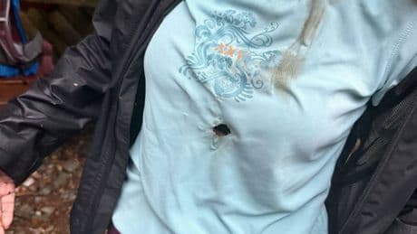 Er ging mitten durchs T-Shirt - Blitz trifft deutsche Touristin in die Brust