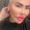 'Britain's Lip King' is found selling weight loss jabs on Facebook despite being on police bail after mother-of-five died following BBL at his clinic