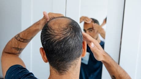 Schön schlank, aber mit Nebenwirkungen: Diese Diät könnte Ihrem Haar schaden