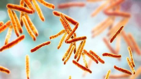 Tuberculosis, cómo identificarla y cuáles son los tratamientos