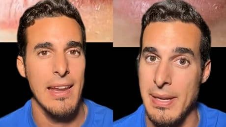 Simón Pardiñas, dentista: "La piel de los labios es mucho más delicada que la del resto del cuerpo"