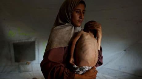 Famine à Gaza : Paris, Londres et Berlin exhortent Israël à débloquer l’aide humanitaire