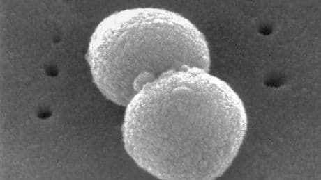 New ‘superbug’ antibiotic to treat sepsis and pneumonia enters last phase of testing