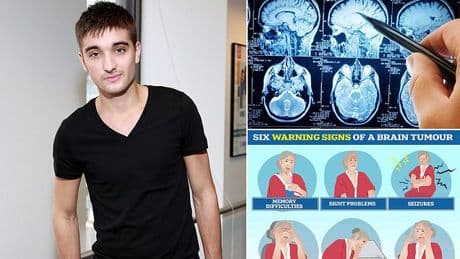 Trigger behind aggressive brain cancer uncovered - hope for prevention