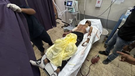 İsrail'in ateşi sonucu bir gazeteci yaralandı, biri hayatını kaybetti