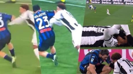 Bologna-Juve, chi arbitra la sfida Champions: quei precedenti con Atalanta, Napoli, Inter...