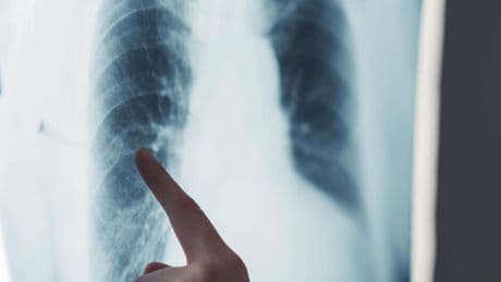 Radiographer suspended after saying he hopes colleague was off sick ‘because they’ve got a brain tumour’