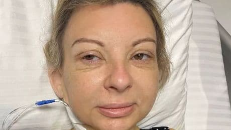 'I had £7,000 weight loss surgery in Turkey and I'm worried I'll rip apart'