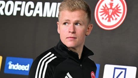 Was der Stürmer dazu sagt - DAS denkt Eintracht über Burkardts Verletzungen
