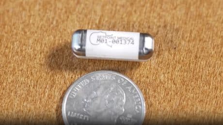 Here’s how a bio implant stopped Long Island woman’s ‘horrific’ athritis in its tracks: ‘This is the future’