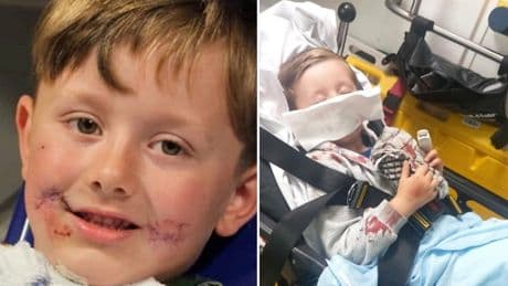 Owner of ‘pocket bully’ which mauled boy, five, blames child for attack
