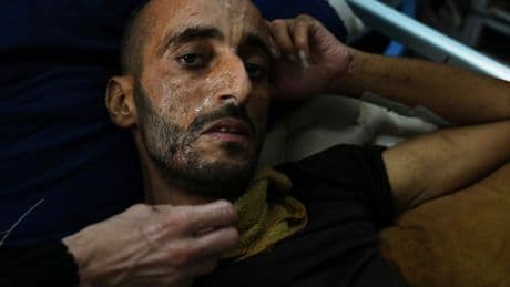 Photos of displaced people in Gaza battling stifling amid food and water shortages