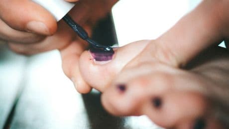 I Just Learned More People Have Six Toenails Than We Realise – Here's How To Spot Yours