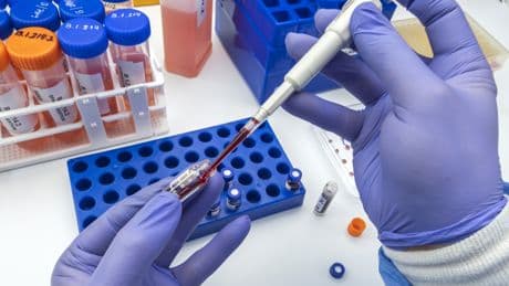 Kann ein Bluttest die Lebensspanne bestimmen? Wissenschaftler wollen den Schlüssel gefunden haben