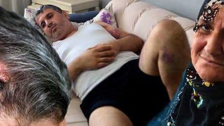 Miras kavgası kanlı bitti: Dayısı beyzbol sopasıyla saldırdı: ‘Doğu adetinde kadına miras yok’