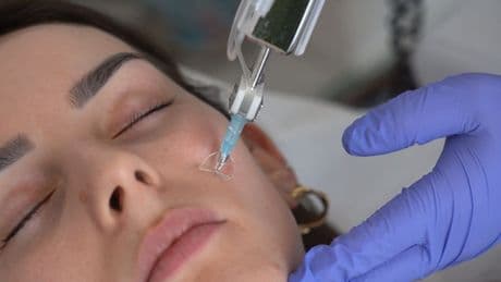 Mésothérapie, le soin expert pour une peau glowy