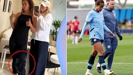 Matildas star Mary Fowler shows off the devastating seriousness of her knee injury for the first time