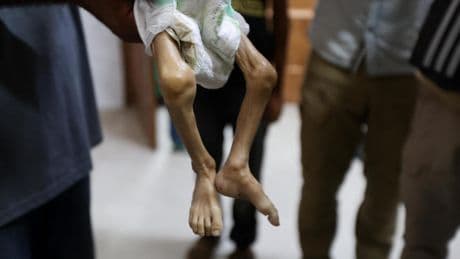 El hambre se agudiza en Gaza: 5 muertos por desnutrición en las últimas 24 horas mientras Israel asfixia el acceso a comida