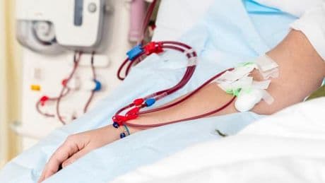 Dialyses abusives dans une clinique privée de Nancy : un rapport d’experts dresse un constat sévère